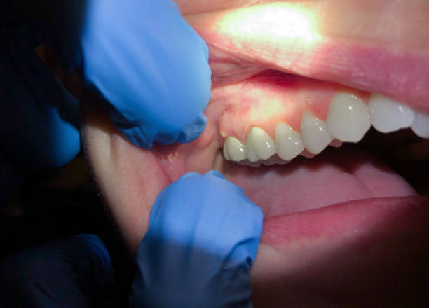 Best Emergency Dental Services for Seniors in Varnville, SC