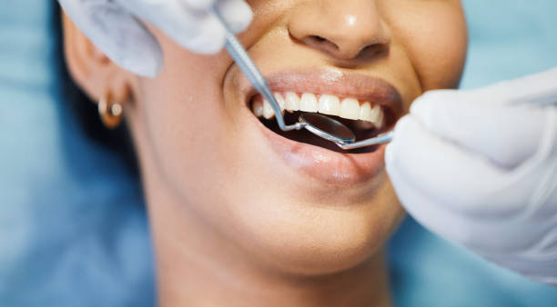 Best Emergency Dentist for Knocked-Out Tooth in Varnville, SC