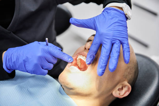 Best Emergency Dental Care for Abscessed Tooth in Varnville, SC